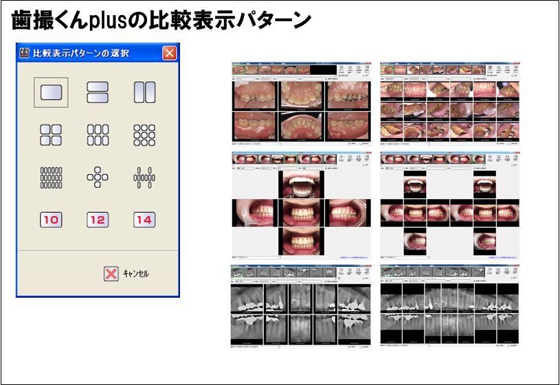 説明に合わせた比較表示